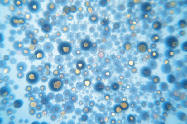 siphylos bacteria under the microscope jta74nfnlxh2m2595j95 0 1