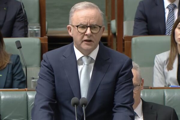 Anthony Albanese1